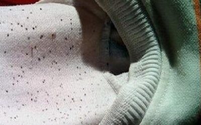 Cách Tẩy Mốc Quần Áo Đơn Giản, Tiết Kiệm